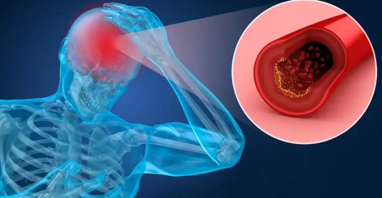 3D Image of Skeleton and brain