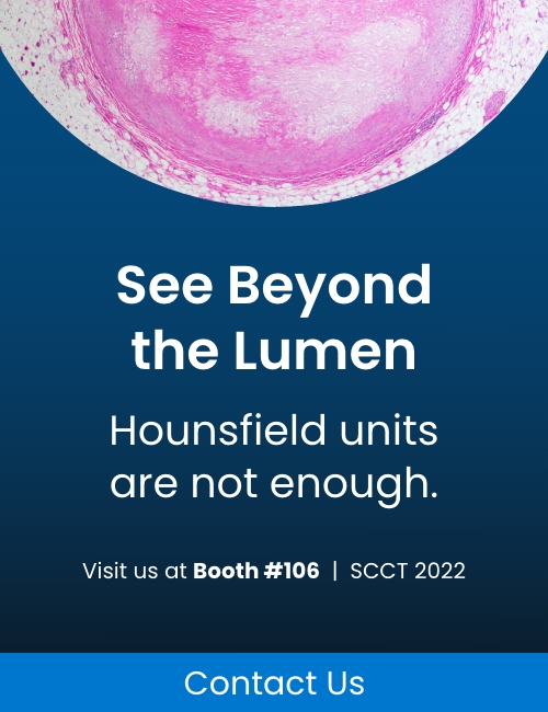 Hounsfield units are not enough. Visit us at SCCT, Booth #106