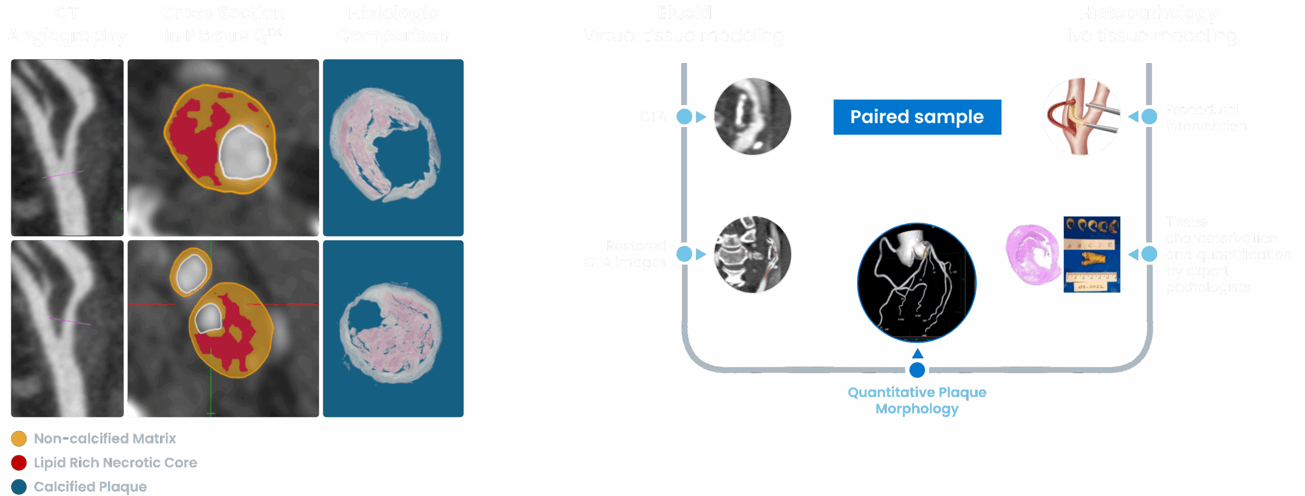 Histogram Labeled ACC with Elucid vs Histology Paired Sample Flow @2x (1) (1)