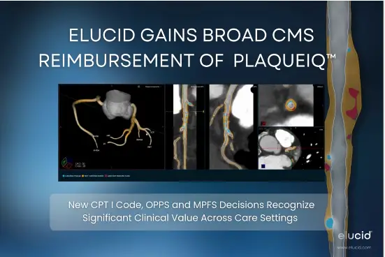 Slide announcing Elucids PlaqueIQ CMS reimbursement, featuring medical imaging and a highlighted artery model.