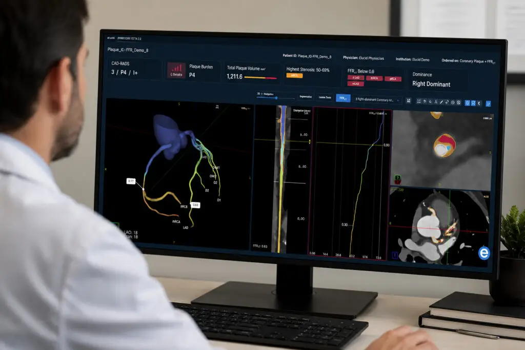 A person analyzes heart imaging data and graphs on a computer monitor in a clinical setting.