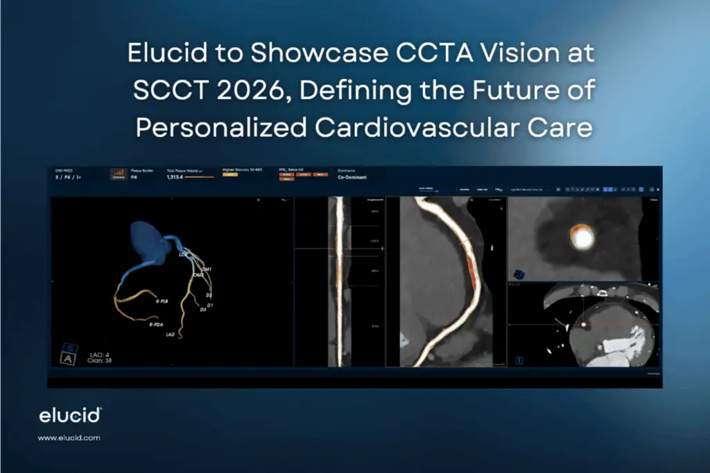 Medical imaging scans and text about Elucid presenting CCTA vision for personalized cardiac care at SCCT 2026.