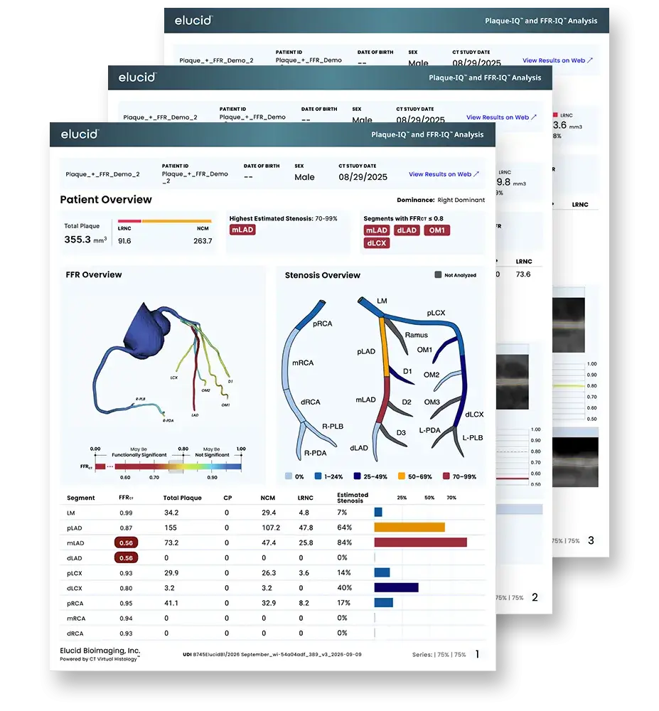 Three overlapping medical report pages, featuring charts, heart diagrams, and patient health data.