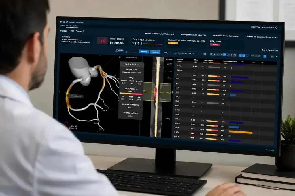 A person examines heart artery data and diagrams on a large medical software display.